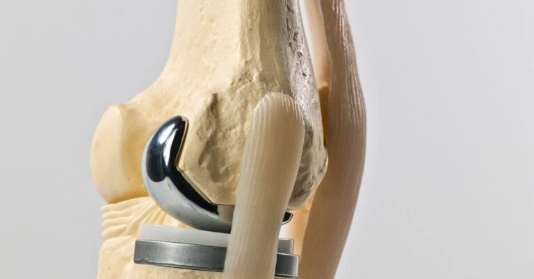 home top 5 mistakes after knee replacement - How to avoid it?